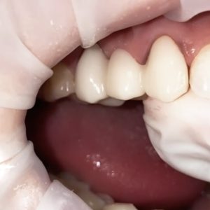 dentacare bruggen